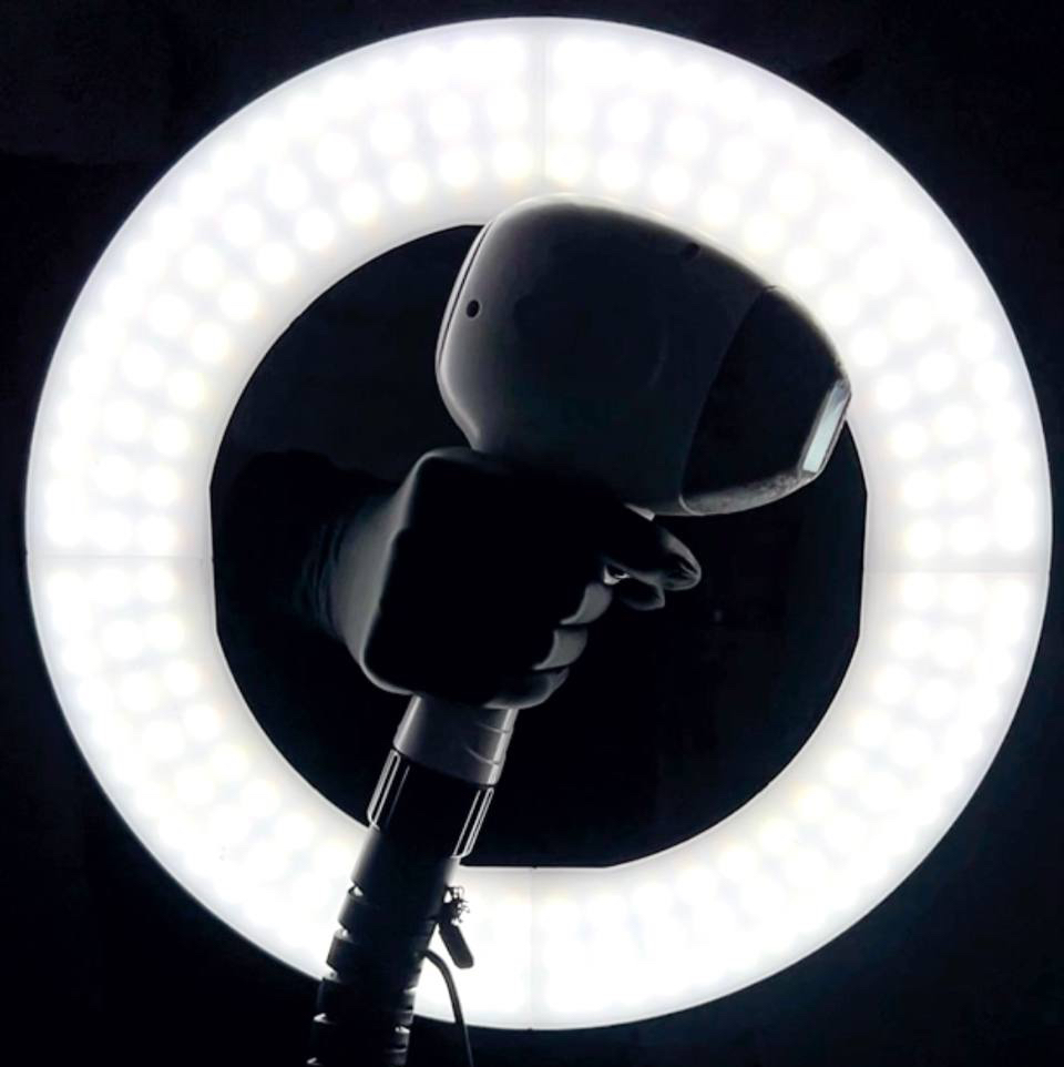 подмышечные впадины  (лазер)