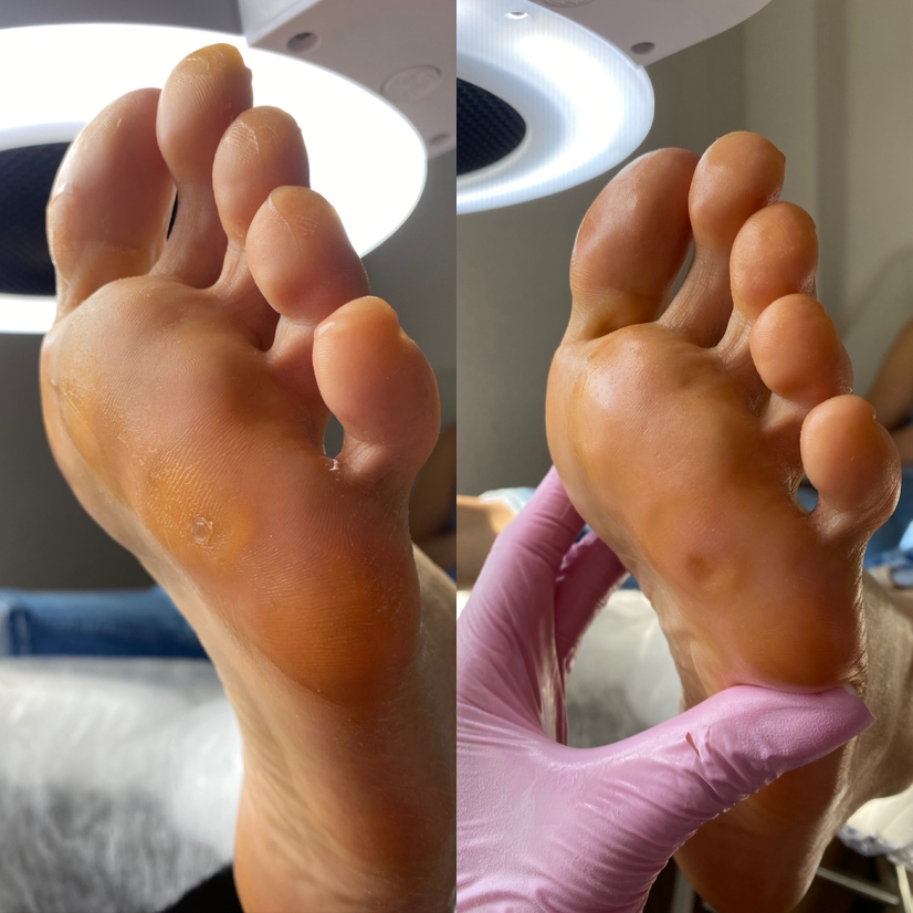 Smart педикюр с покрытием