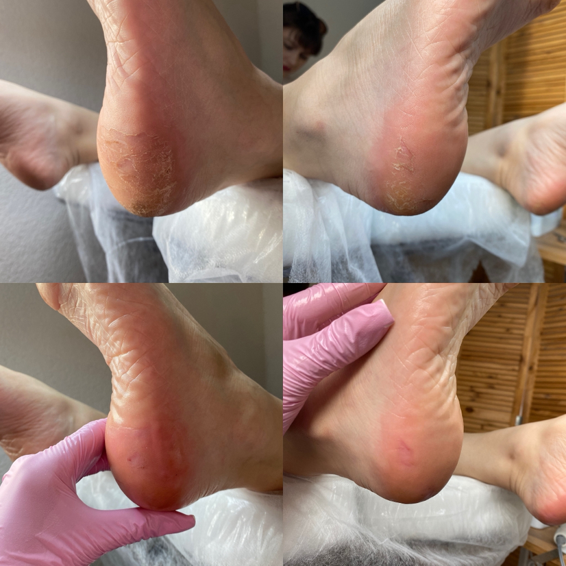 Снятие и Smart педикюр без покрытия