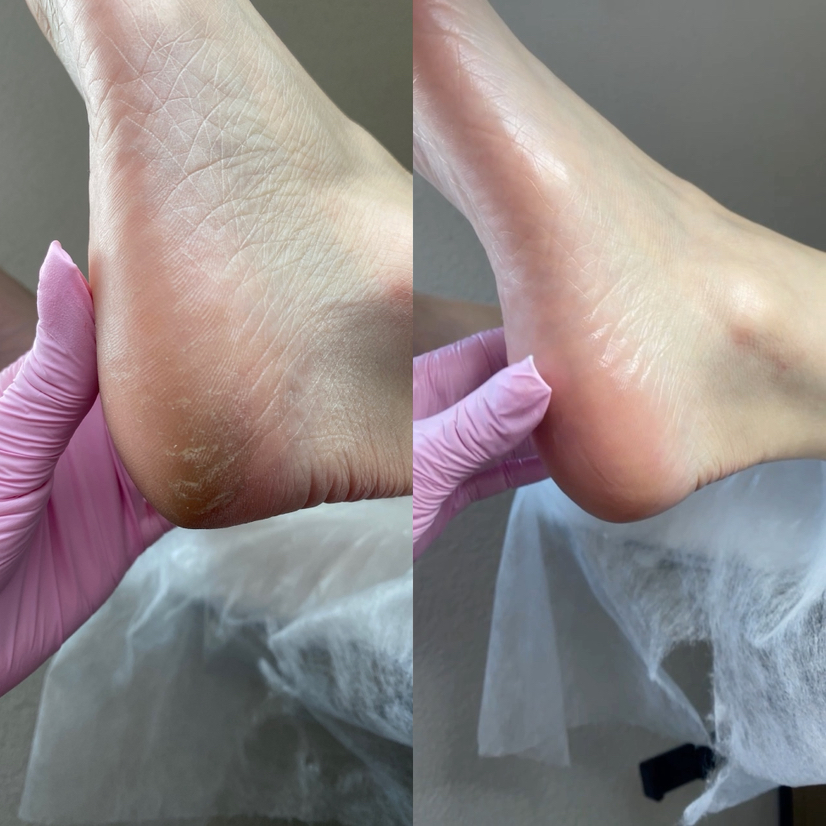 Smart педикюр без покрытия