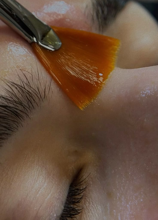 Проблемная кожа  Демакияж + тонизация +энзимный пилинг+ комбинированная чистка+ маска поросуживающая кремовая  /альгинатная + завершающий крем + дарсо