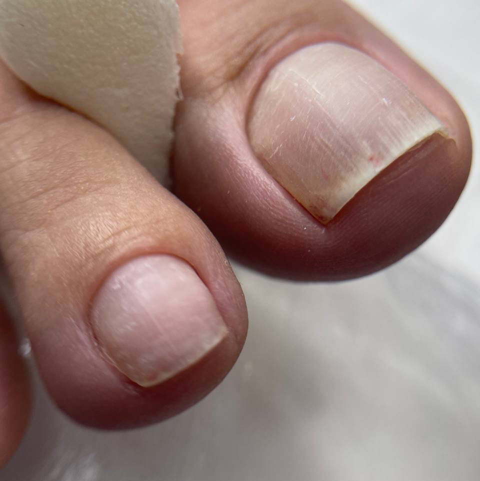 Педикюр пальчиков без покрытия гель лака