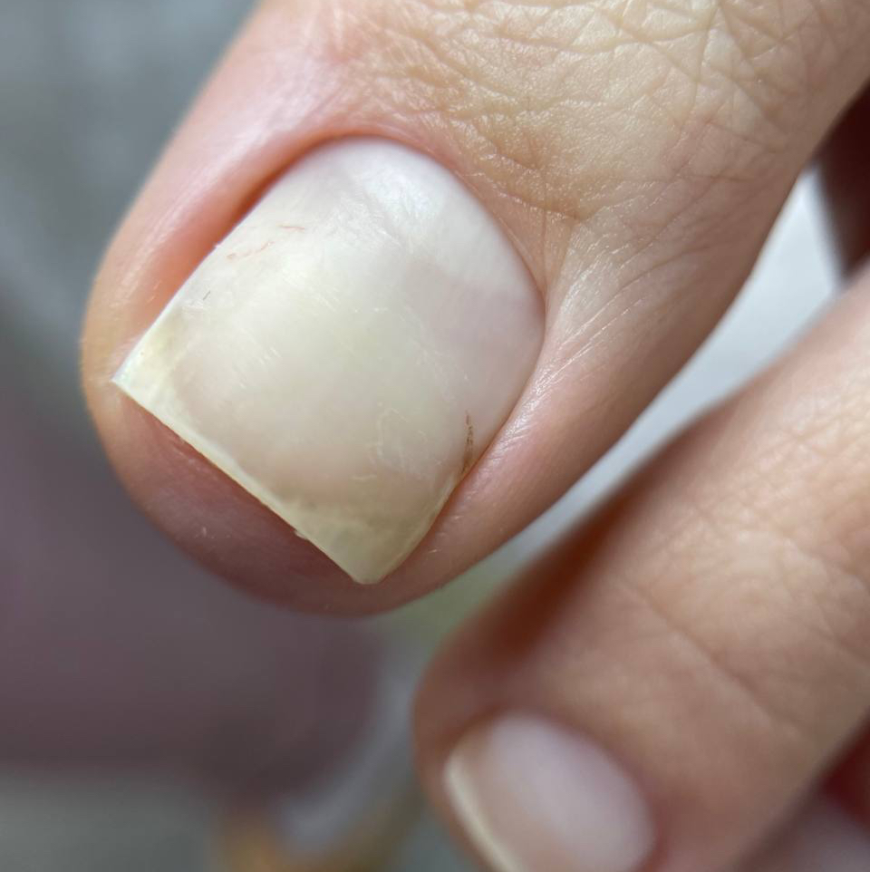 Смарт педикюр стоп + педикюр пальчиков