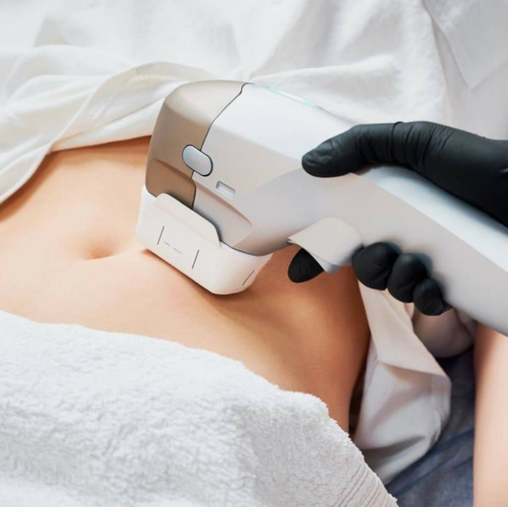 SMAS - лифтинг живот