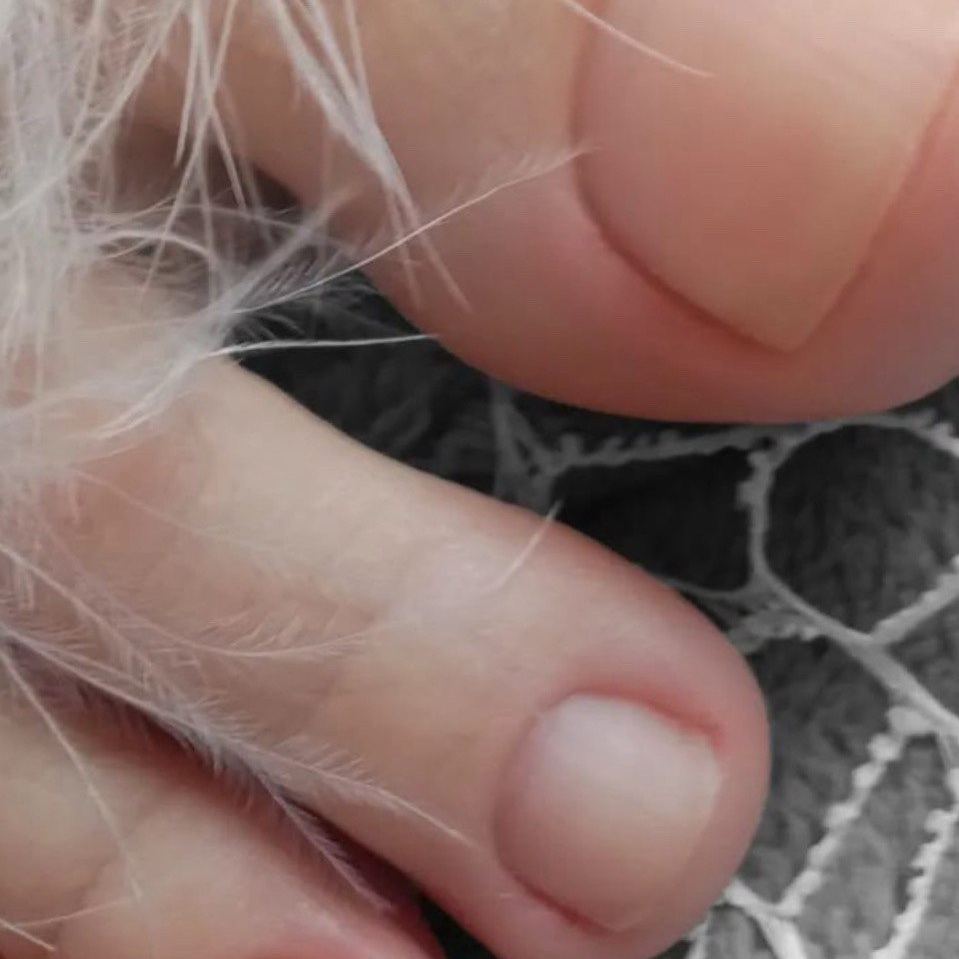 Обработка пальцев (без стопы)