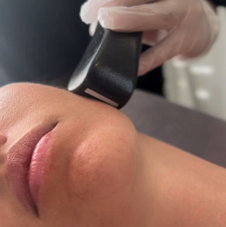 LPG массаж лица (Пробный сеанс)