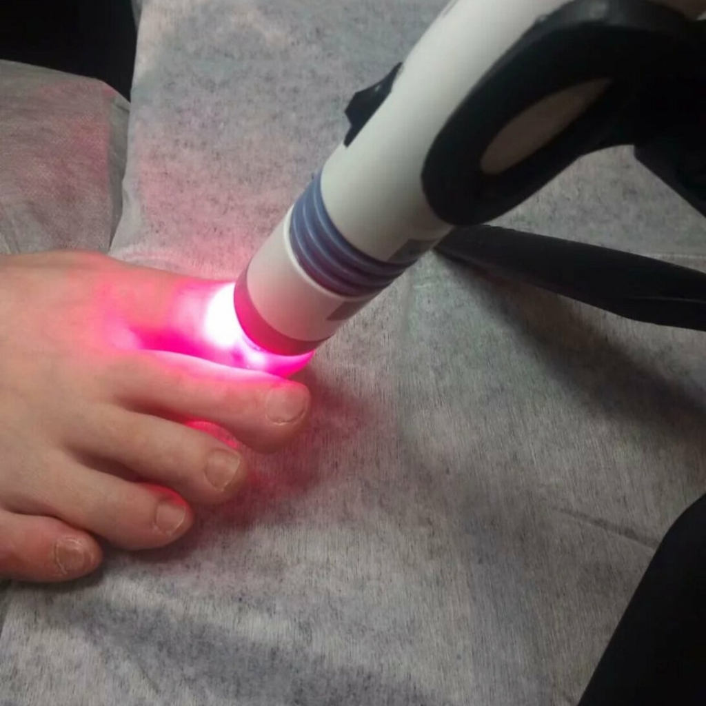 АФС фотодинамическая терапия