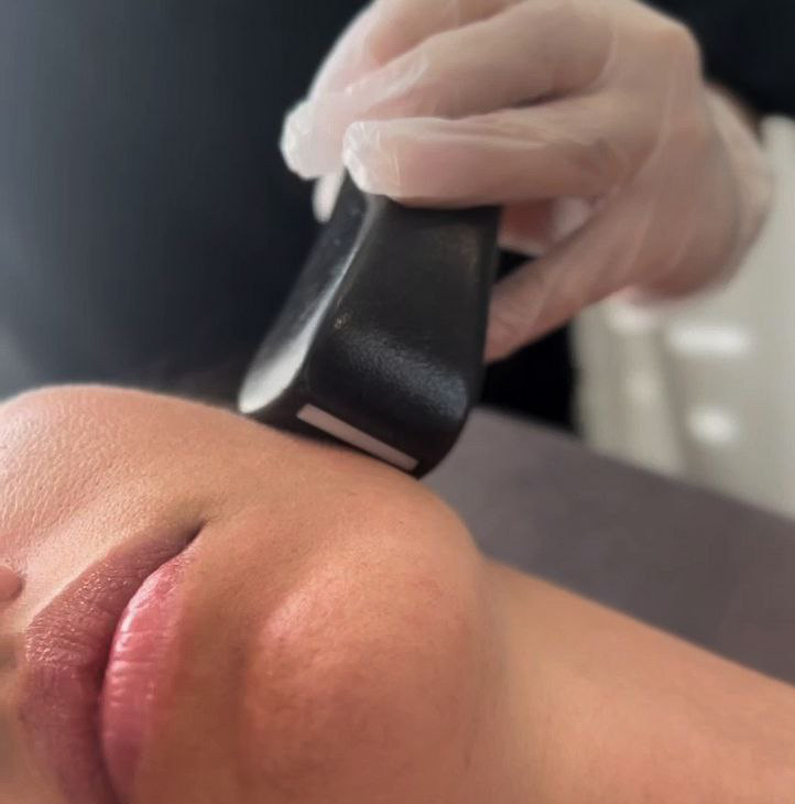 LPG массаж лица