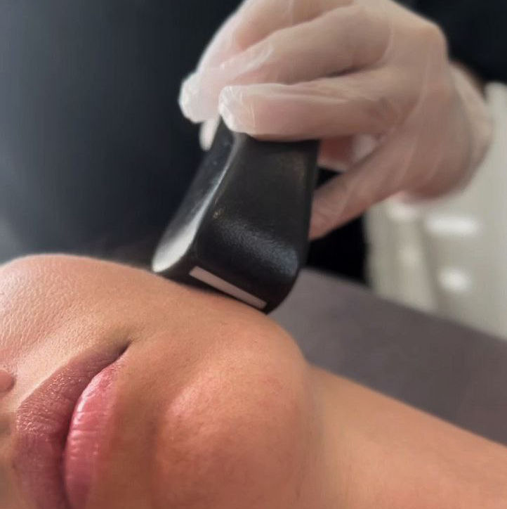 Абонемент LPG лица 5 сеансов