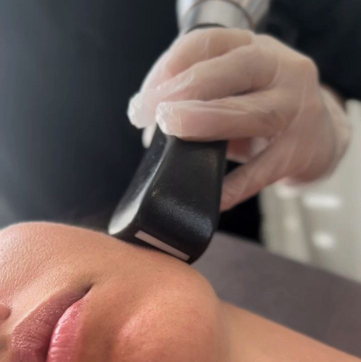 Абонемент LPG лица 10 сеансов