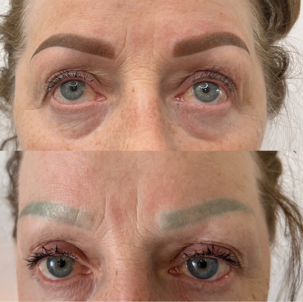 Перекрытие чужих неудачных работ ( старого татуажа, сделанного другими мастерами).