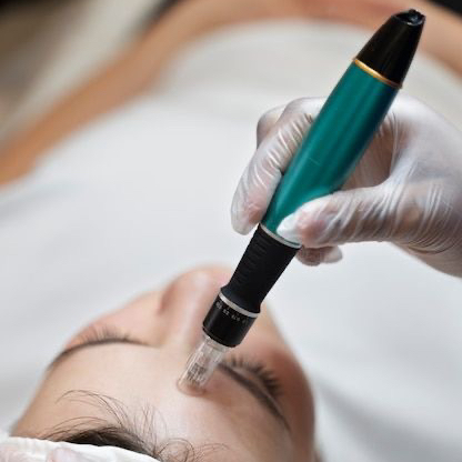 ПИЛИНГ + DERMAPEN