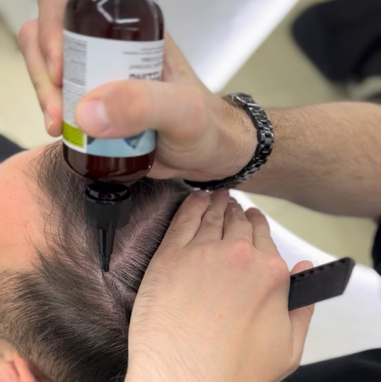 Пилинг кожи головы