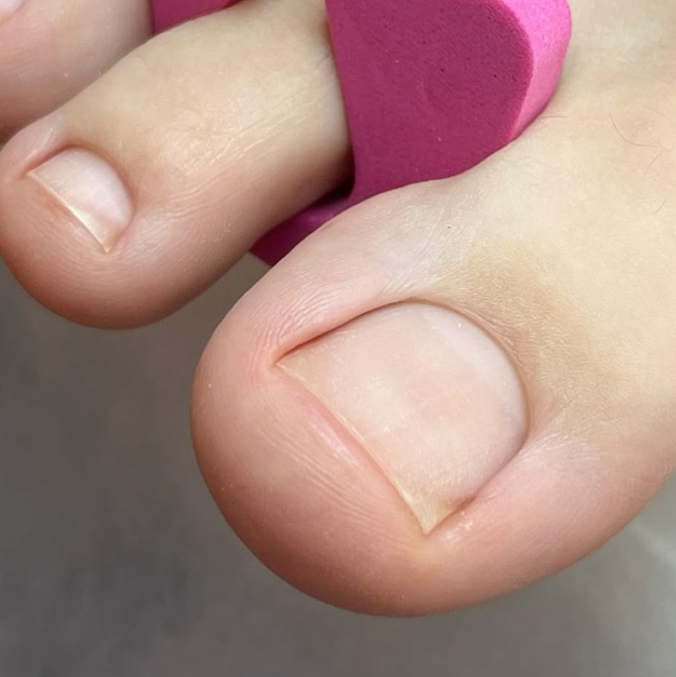 Педикюр пальчики