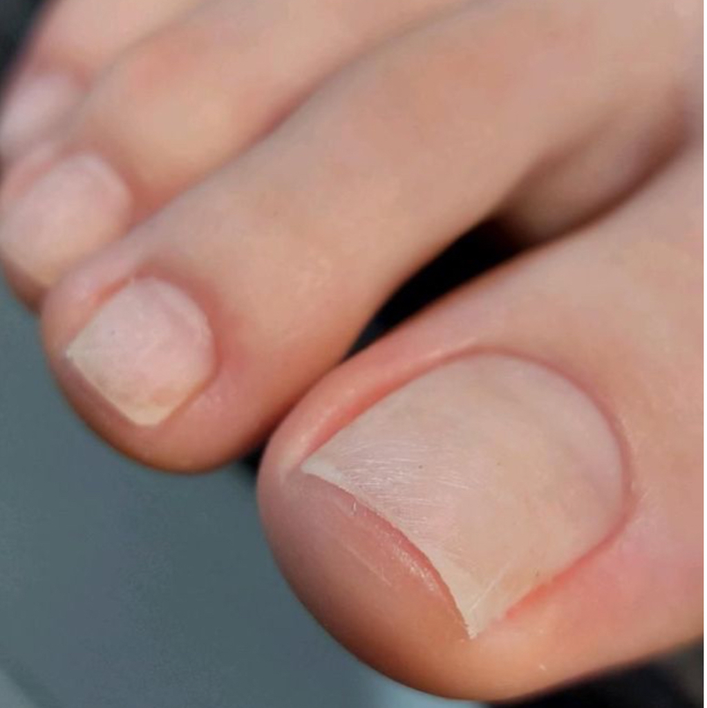 Педикюр (обработка пальчиков) без покрытия