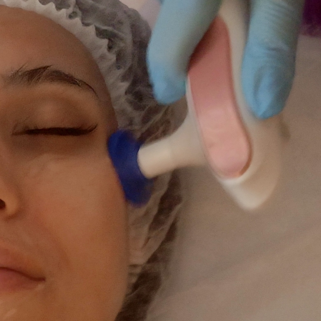 Абонемент на 7 сеансов Индиба по лицу