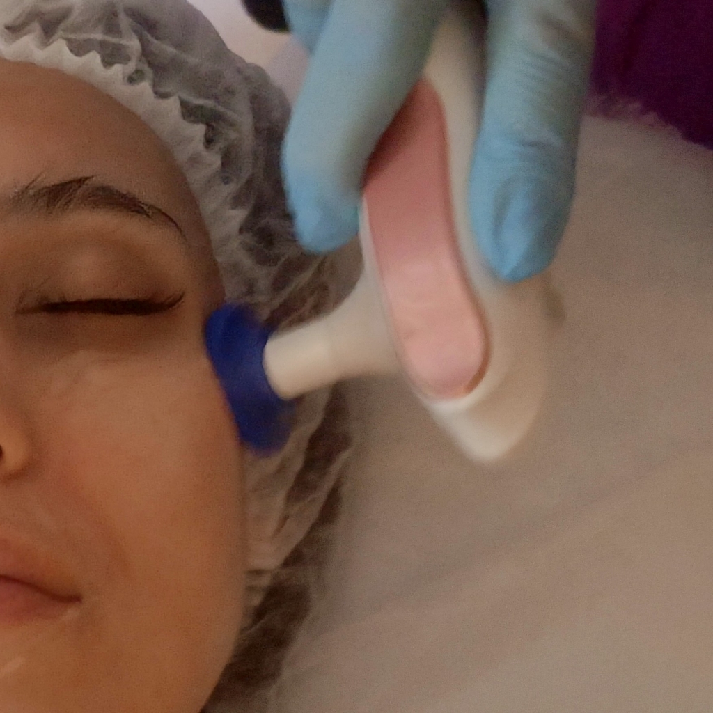 Абонемент на 10 сеансов Индиба по лицу