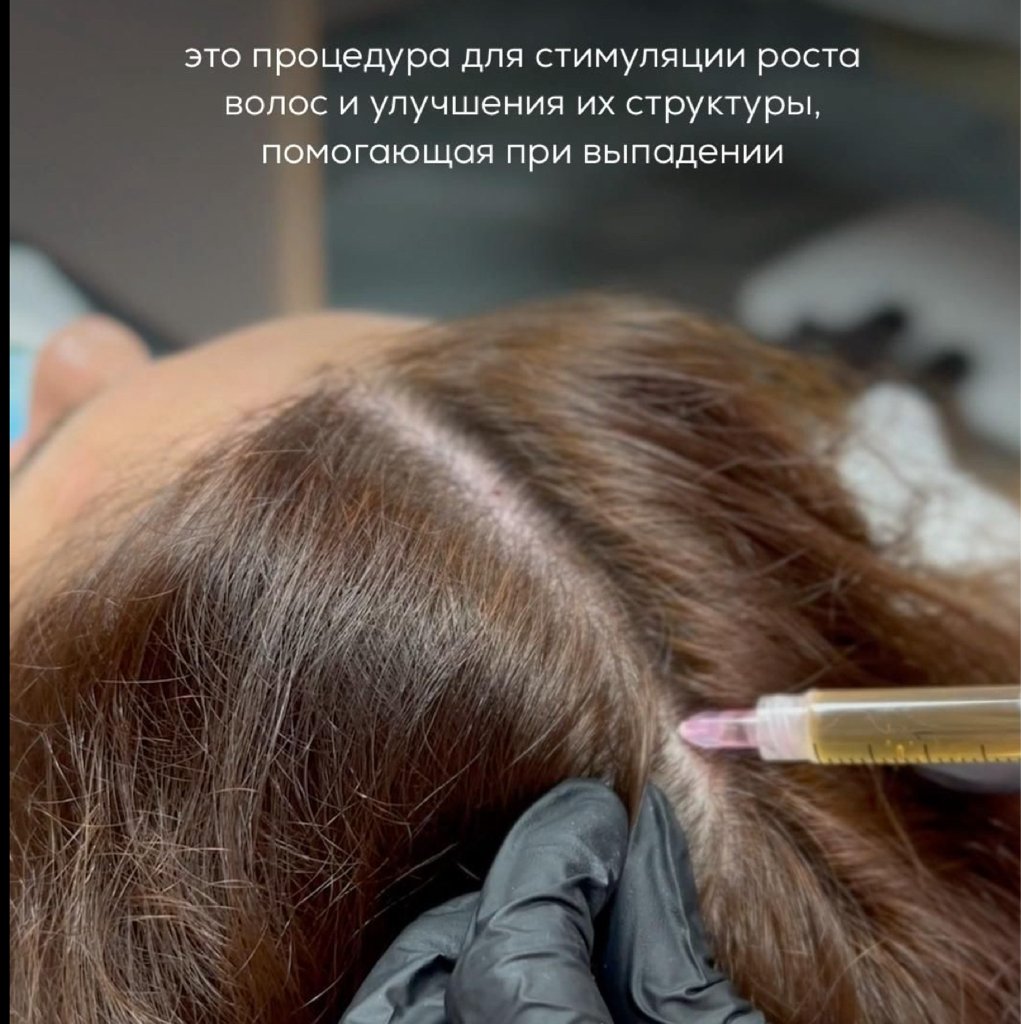 Мезотерапия волос