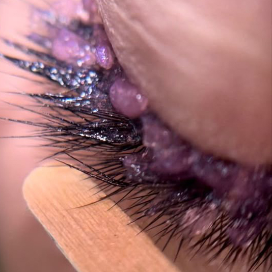 Снятие ресниц (чужая работа)