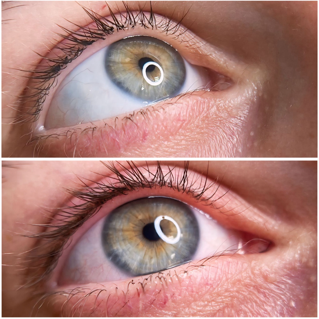 Перманентный макияж зона межресничное пространство век