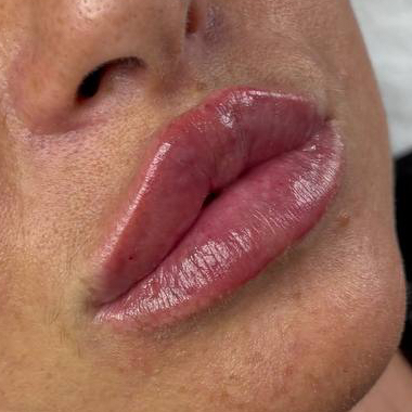 КОЛЛАГЕНОВЫЕ ГУБЫ 👄        
Без увеличения❗️