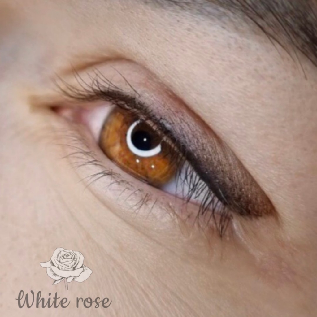 Межресничка, Веки (ПМ)