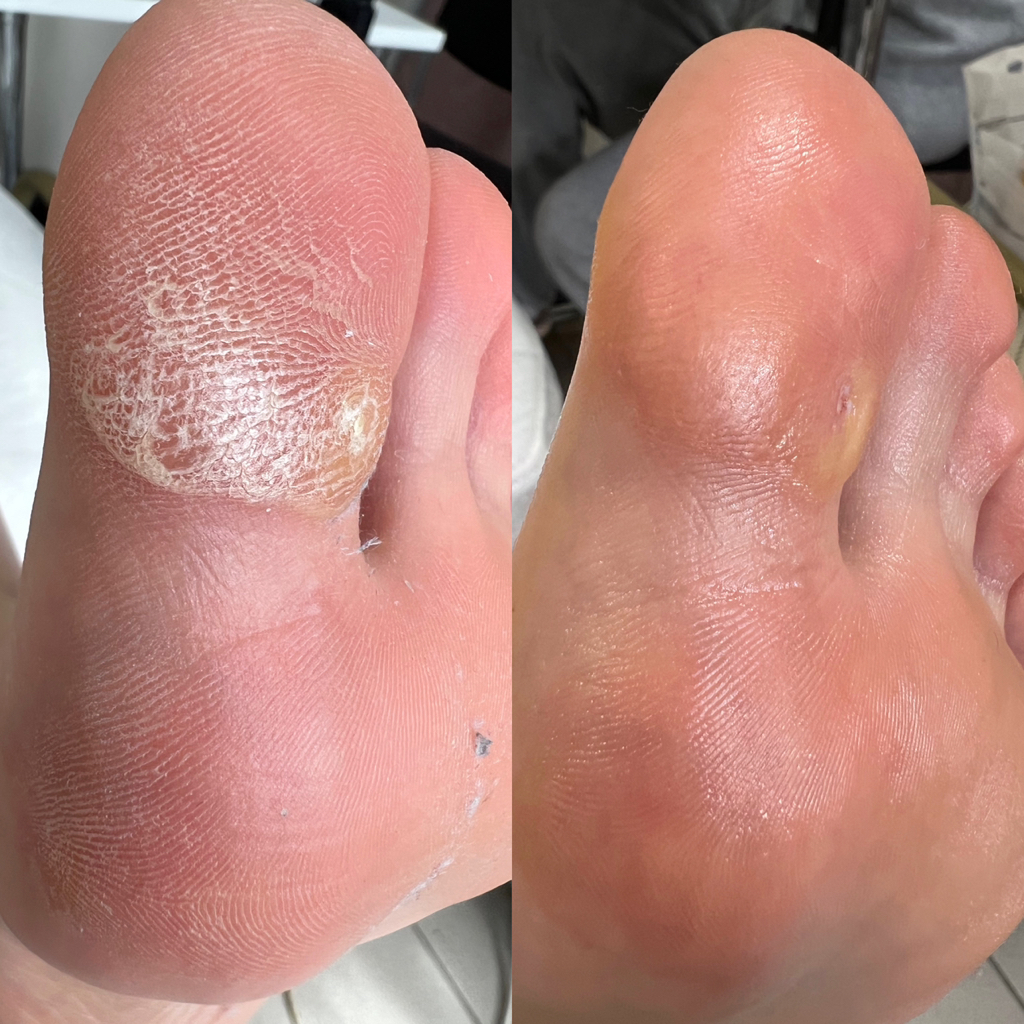 Педикюр с фруктовыми кислотами на Израильской косметике FBA без покрытия