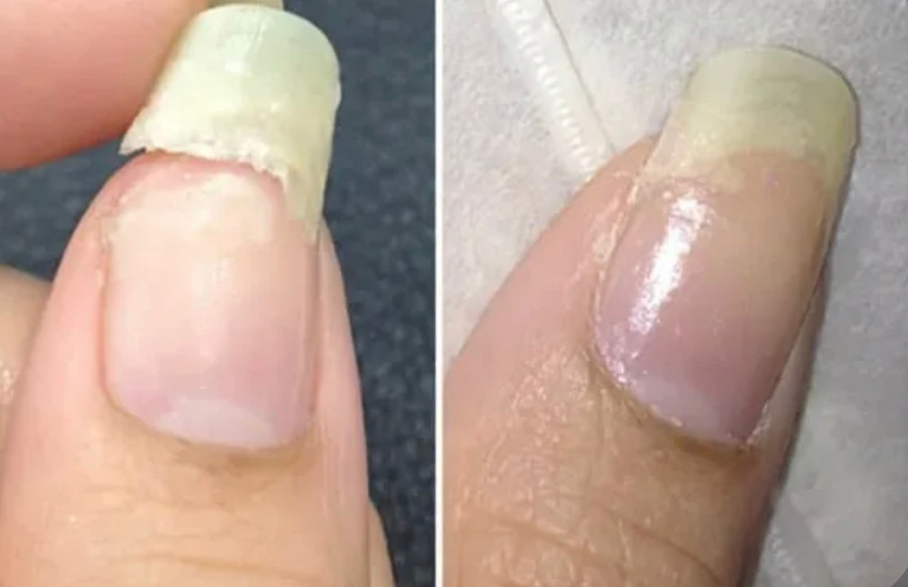 Ремонт (одного ногтя)