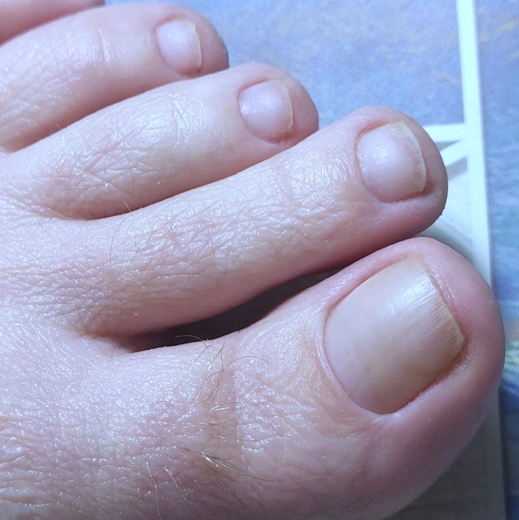 Педикюр обработка пальчиков без покрытия