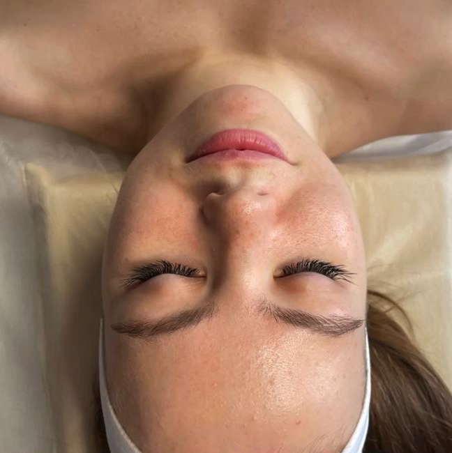 Лифтинг лица LPG разово - (15 минут )