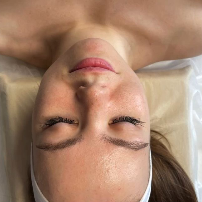 Лифтинг лица разово - (10 минут)