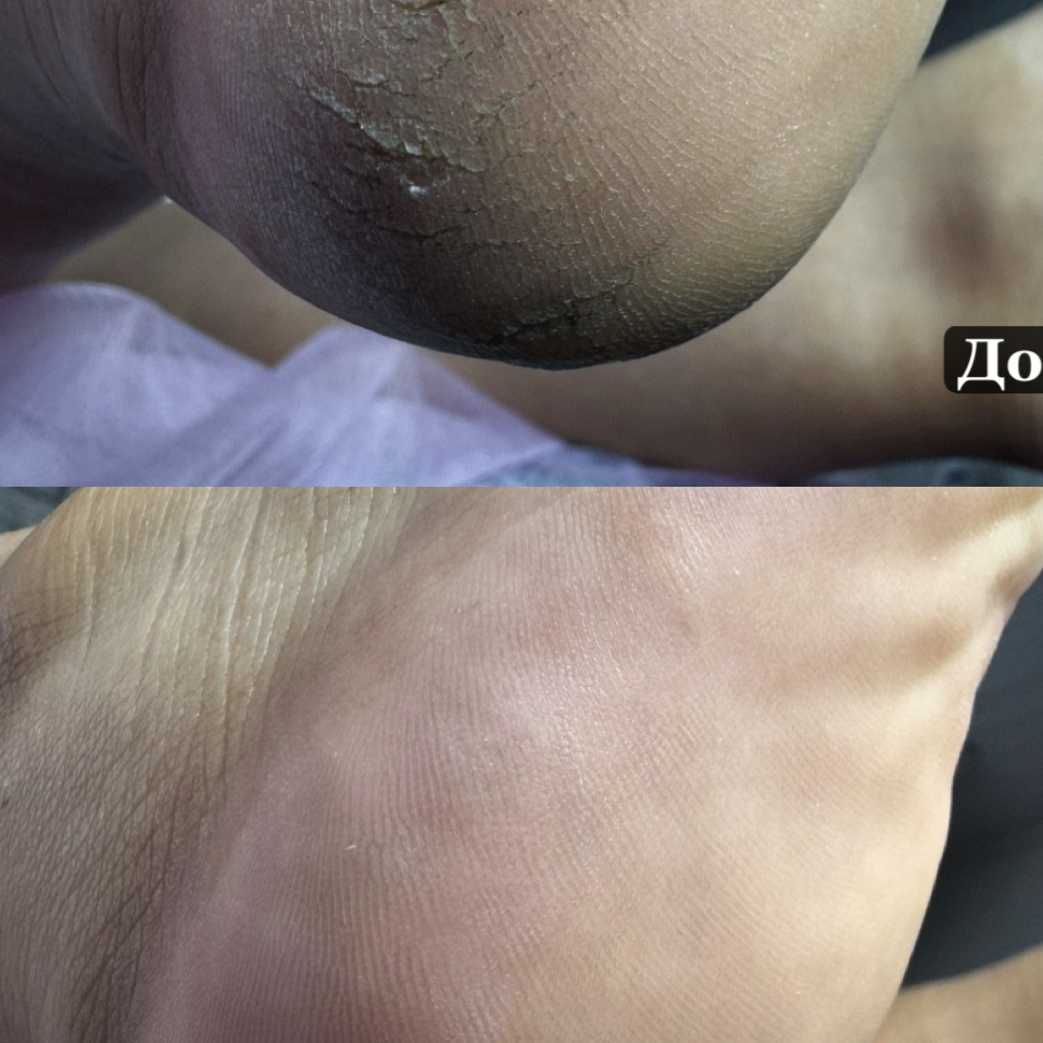 Педикюр с обработкой стопы и покрытие гель-лаком