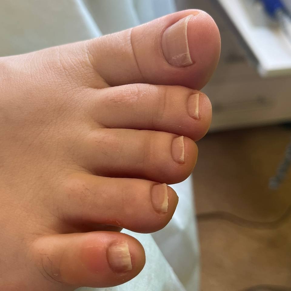 Педикюр Smart эстетика