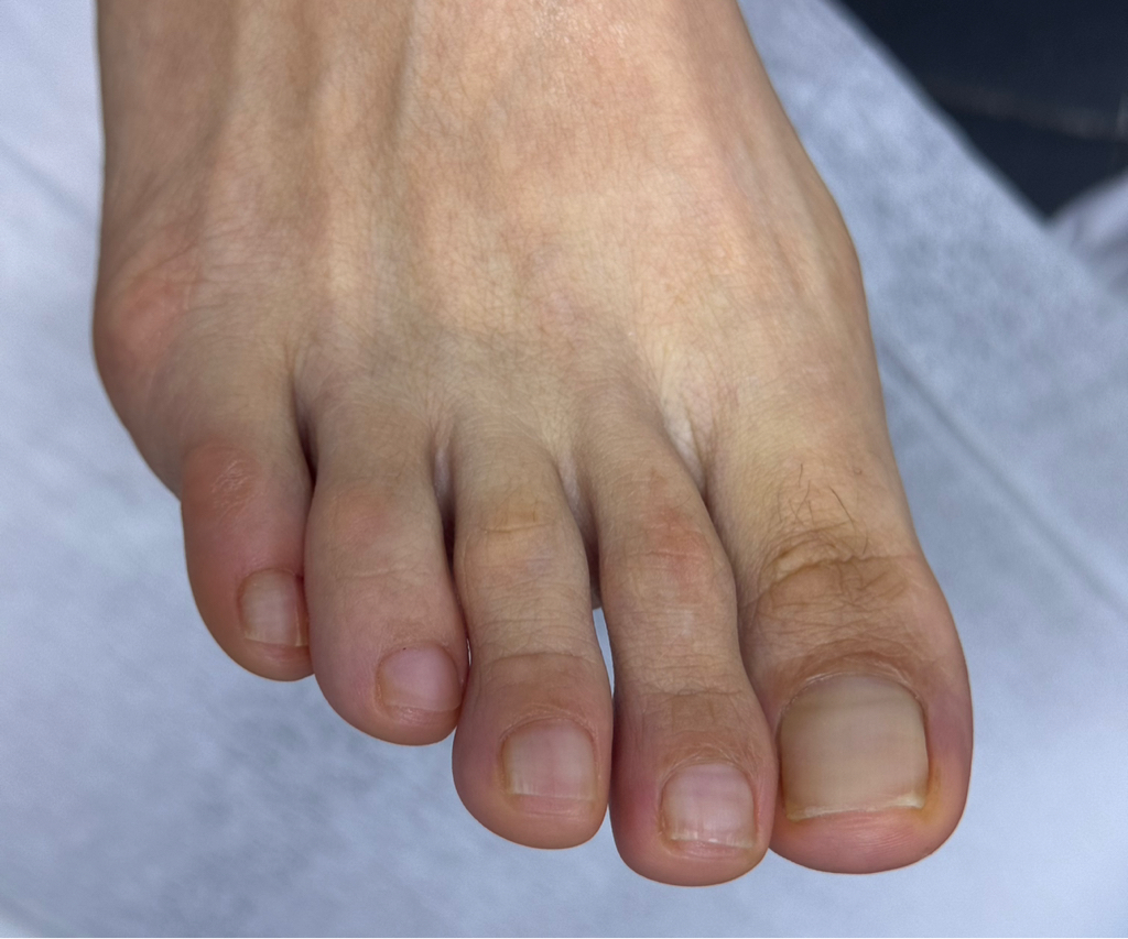 Комплексный препаратный педикюр без покрытия