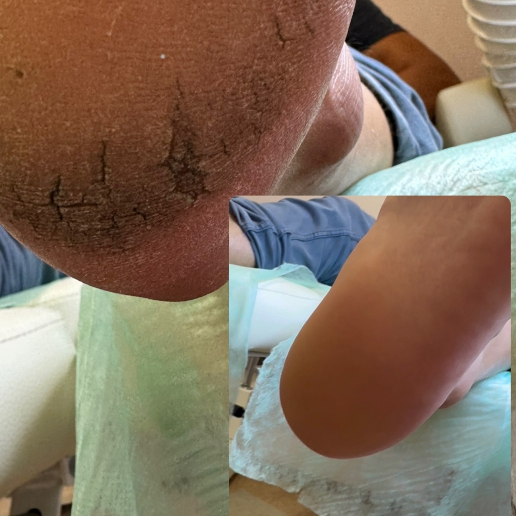 Усложнение услуги ПОДОЛОГИЯ