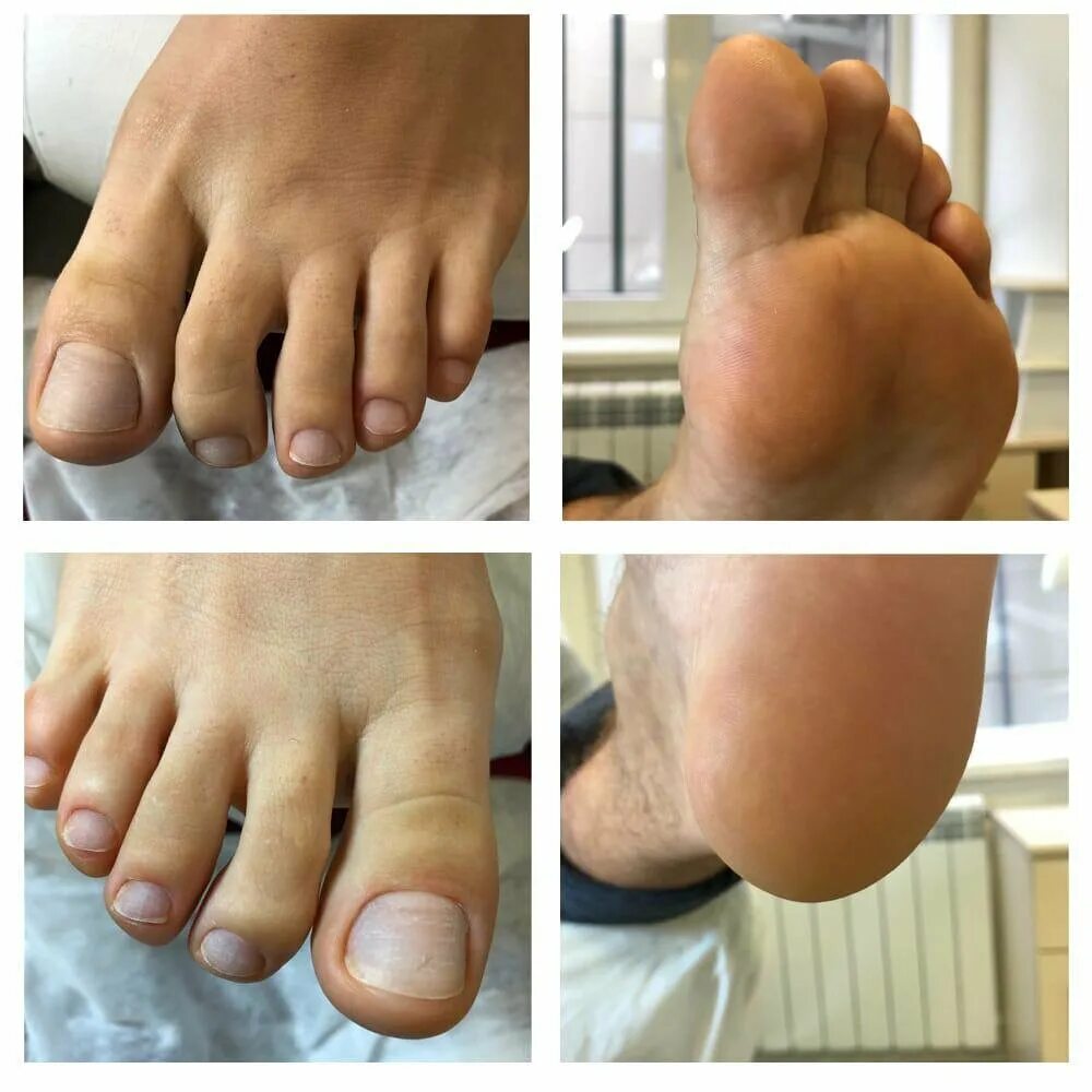 Педикюр мужской Kart