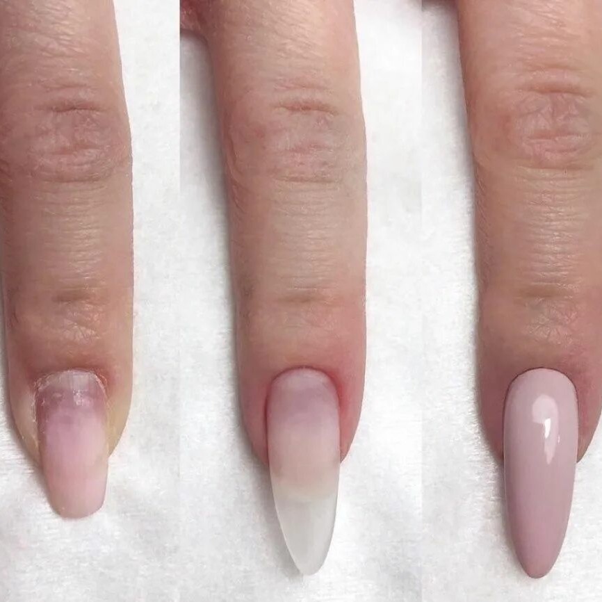 Наращивание 1 ногтя