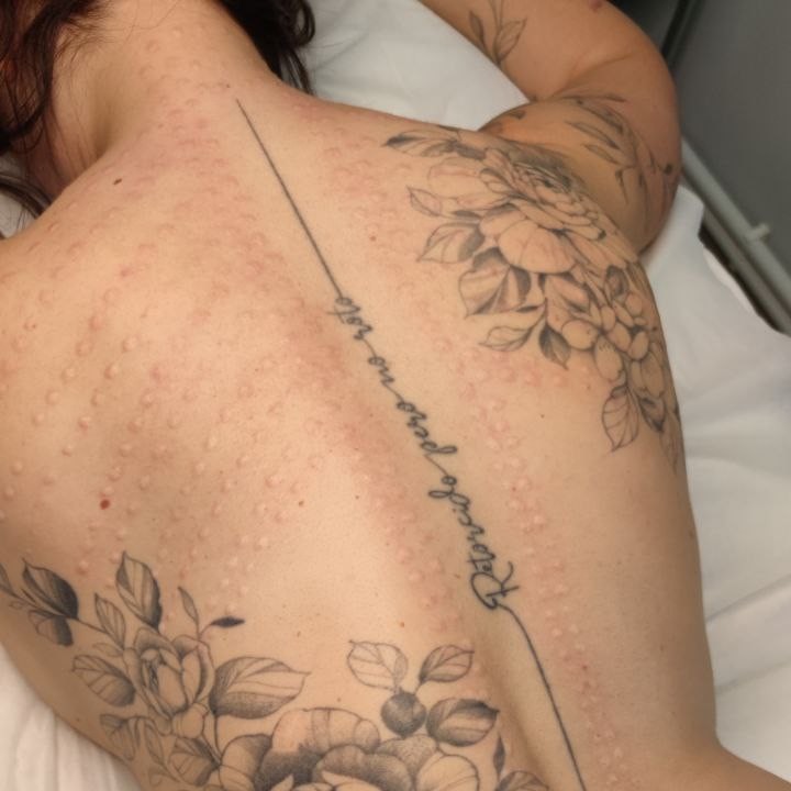 Сосудистый этап