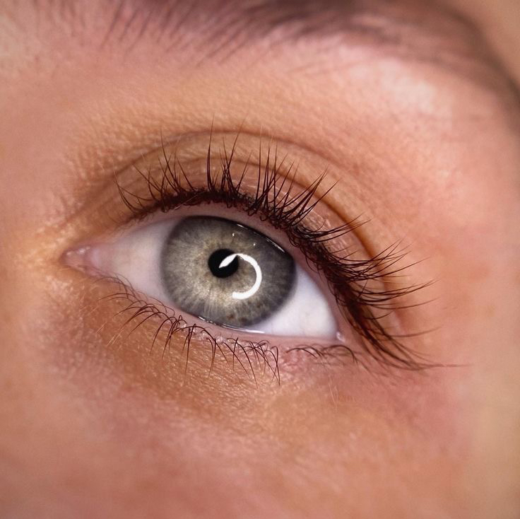 Коррекция межресничного пространства