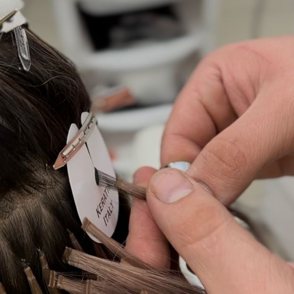 загущение височной зоны