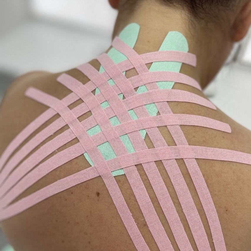 Тейпирование