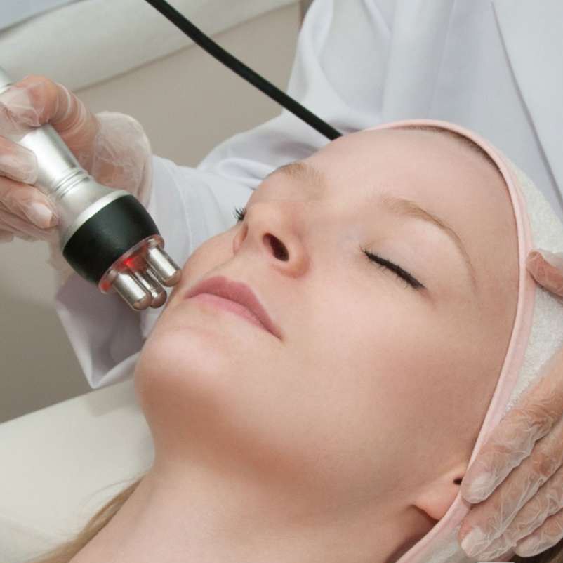 RF лифтинг лица (по аб-ту 5 пр)