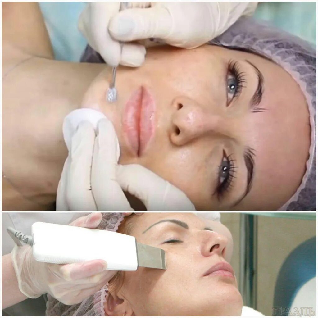 Комбинированная чистка лица