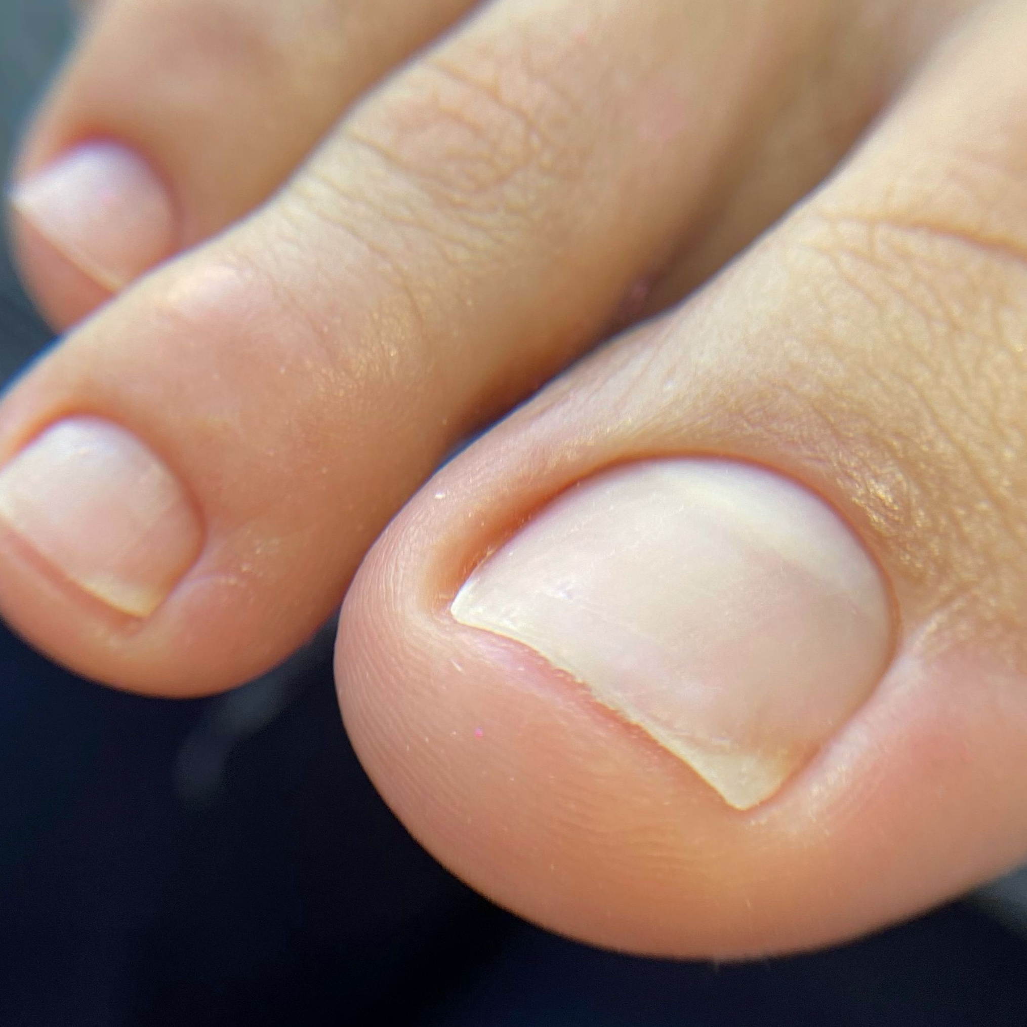 Аппаратный/Препаратный педикюр