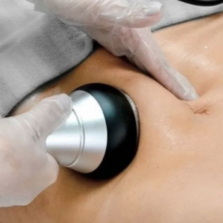 Кавитация 1 зоны на выбор
абонемент на 5 процедур