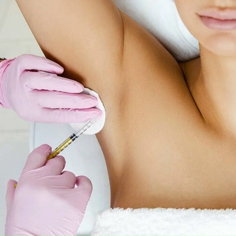 Ботулинотерапия (Гипергидроз) 
по количеству ЕД