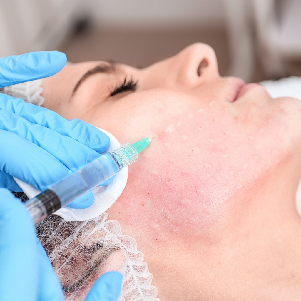 Биоревитализация индивидуальный подбор препаратов 
(по договорённости)