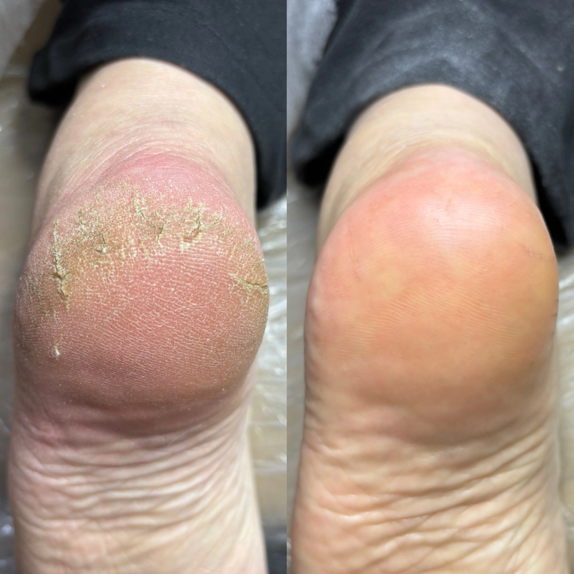 Частичный Педикюр-обработка стопы и пальцев без покрытия