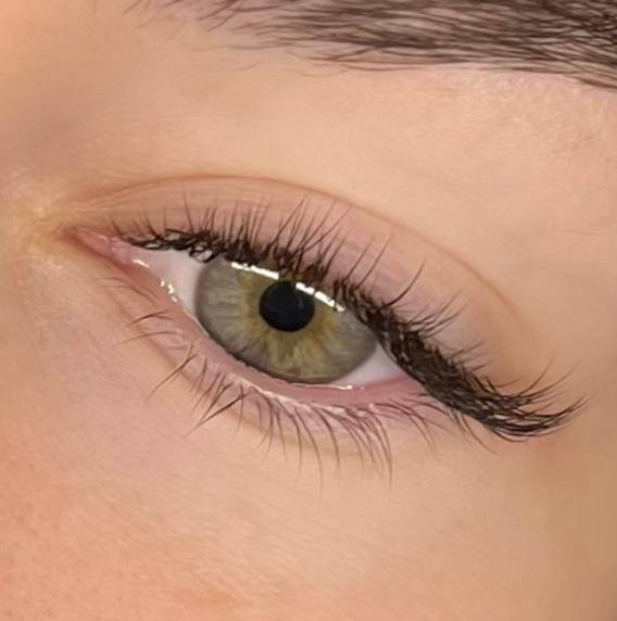 Skropstu pieaudzēšana/Klasika