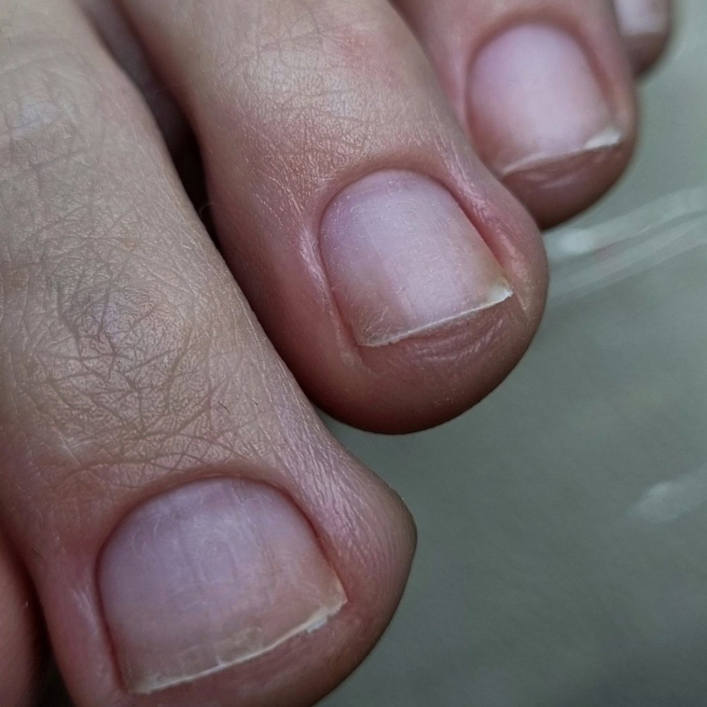 Гигиенический педикюр